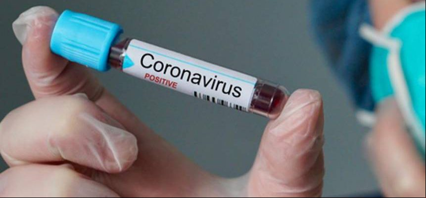 20200310113144_860_645_-_laboratorio_busca_voluntarios_para_testar_vacina_de_coronavirus